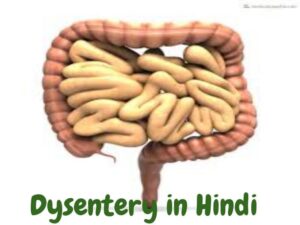 Dysentery in Hindi- पेचिश (आंव) के कारण प्रकार और उपचार