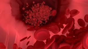 Read more about the article Blood cancer in hindi- ब्लड कैंसर के शुरुआती लक्षण और इलाज