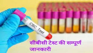 Read more about the article CBC test in Hindi सीबीसी टेस्ट क्या है और टेस्ट के नार्मल रेंज की समूर्ण जानकारी