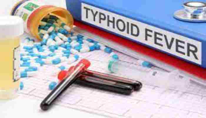 Typhoid ke lakshan टायफॉइड के लक्षण कारण बचाव निदान और उपचार