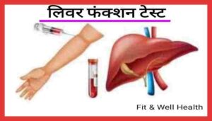 Read more about the article Liver function in Hindi लिवर के कार्य जिगर रोगों के लक्षण एवं टेस्ट के प्रकार