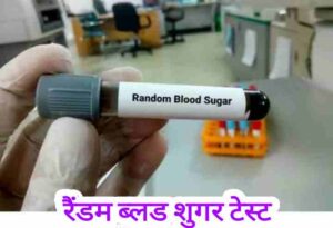 RBS test in Hindi रैंडम ब्लड शुगर टेस्ट क्या है क्यों किया जाता है और आरबीएस की नार्मल वैल्यू
